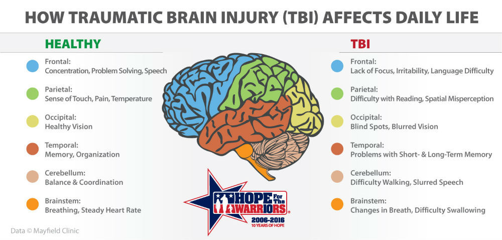 Tramatic Brain Injury - Hyperbaric